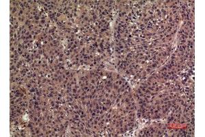 Immunohistochemistry (IHC) analysis of paraffin-embedded Human Lung, antibody was diluted at 1:100. (FIL1h 抗体  (Internal Region))