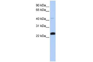 LYCAT antibody used at 1 ug/ml to detect target protein. (LCLAT1 抗体  (Middle Region))