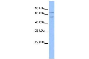 WB Suggested Anti-TRAP1 Antibody Titration: 1. (TRAP1 抗体  (N-Term))