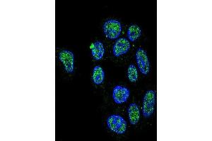 Confocal immunofluorescent analysis of ZN Antibody (Center) (ABIN653731 and ABIN2843038) with HepG2 cell followed by Alexa Fluor 488-conjugated goat anti-rabbit lgG (green). (ZNF202 抗体  (AA 342-370))