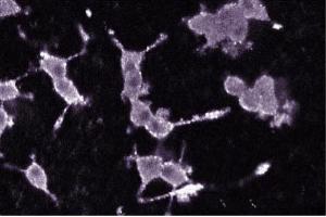 Immunofluorescence staining of PC12 cells (Rat neuroblastoma, ATCC CRL-1721). (PKC alpha 抗体  (AA 270-427))