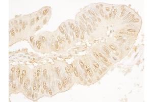 Immunohistochemistry (IHC) image for anti-Stromal Antigen 2 (STAG2) (AA 1-50) antibody (ABIN7454842)