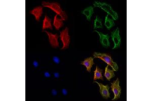 ABIN6264457 and ABIN6272976 staining Hela cells by IF/ICC.