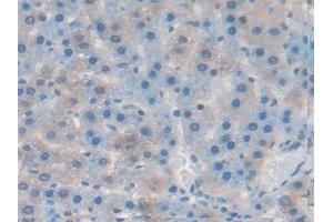Immunohistochemistry (IHC) image for anti-Tumor Necrosis Factor (Ligand) Superfamily, Member 11 (TNFSF11) (AA 106-240) antibody (ABIN7432757)
