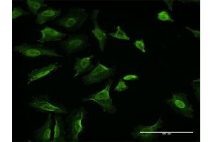 Immunofluorescence of monoclonal antibody to VCL on HeLa cell. (Vinculin 抗体  (AA 1-1066))
