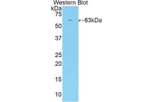 Detection of Recombinant SULF2, Human using Polyclonal Antibody to Sulfatase 2 (SULF2) (SULF2 抗体  (AA 337-649))