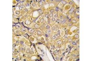Immunohistochemistry (IHC) image for anti-Transient Receptor Potential Cation Channel, Subfamily M, Member 8 (TRPM8) (AA 521-552) antibody (ABIN3029240)