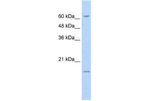 WB Suggested Anti-SLC13A3 Antibody Titration:  5. (SLC13A3 抗体  (N-Term))
