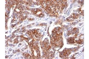 Image no. 2 for anti-Keratin 18 (KRT18) antibody (ABIN3026949) (Cytokeratin 18 抗体)