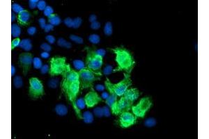 Image no. 5 for anti-SUMO1/sentrin/SMT3 Specific Peptidase 2 (SENP2) (AA 139-523) antibody (ABIN1490926)