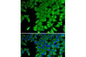 Immunofluorescence analysis of U2OS cells using CRABP2 Polyclonal Antibody (CRABP2 抗体)