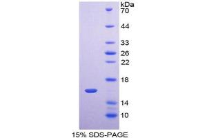 SDS-PAGE analysis of Human TMEM27 Protein. (TMEM27 蛋白)