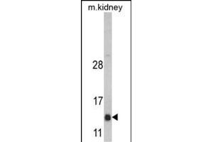 Western blot analysis of DNAJC19 Antibody (Center) (ABIN390453 and ABIN2840826) in mouse kidney tissue lysates (35 μg/lane). (DNAJC19 抗体  (AA 55-84))
