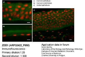 Image no. 3 for anti-Zinc Finger E-Box Binding Homeobox 1 (ZEB1) (N-Term) antibody (ABIN2779631) (ZEB1 抗体  (N-Term))