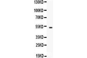 Western blot analysis of FCGRT expression in A549 whole cell lysates (lane 1). (FcRn 抗体  (AA 56-291))