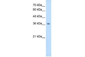 WB Suggested Anti-WNT16 Antibody Titration:  2. (WNT16 抗体  (C-Term))