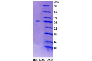 SDS-PAGE analysis of Mouse LRP1B Protein. (LRP1B 蛋白)