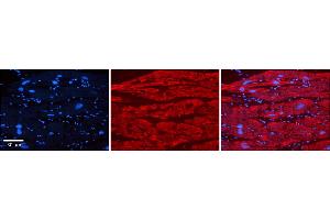 Rabbit Anti-TRIM10 Antibody    Formalin Fixed Paraffin Embedded Tissue: Human Adult heart  Observed Staining: Cytoplasmic Primary Antibody Concentration: 1:600 Secondary Antibody: Donkey anti-Rabbit-Cy2/3 Secondary Antibody Concentration: 1:200 Magnification: 20X Exposure Time: 0. (TRIM10 抗体  (Middle Region))