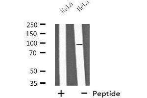 Western blot analysis of extracts from HeLa cells, using PA2G6 antibody. (PLA2G6 抗体  (Internal Region))