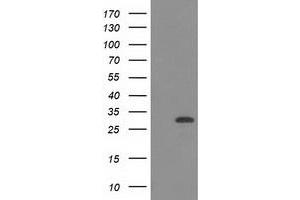 Image no. 7 for anti-CTD (Carboxy-terminal Domain, RNA Polymerase II, Polypeptide A) Small Phosphatase 1 (CTDSP1) antibody (ABIN1497679) (CTDSP1 抗体)