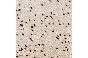 Immunohistochemistry (Paraffin-embedded Sections) (IHC (p)) image for anti-Hairy and Enhancer of Split 2 (HES2) antibody (ABIN7074158)
