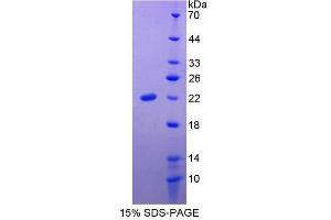 SDS-PAGE analysis of Human Slit Homolog 3 Protein. (SLIT3 蛋白)
