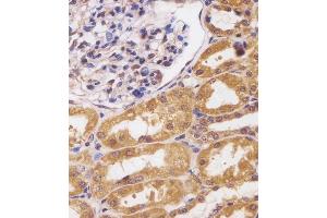 Immunohistochemistry (Paraffin-embedded Sections) (IHC (p)) image for anti-Cut-Like Homeobox 1 (CUX1) (AA 1347-1374) antibody (ABIN652075)