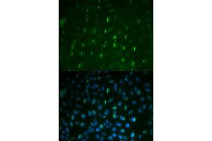 Immunofluorescence analysis of U2OS cells using Phospho-H2AFX-S139 antibody (ABIN5969940). (H2AFX 抗体  (pSer139))