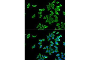 Immunofluorescence analysis of U2OS cells using HTR2B antibody (ABIN6127310, ABIN6142069, ABIN6142070 and ABIN6221320). (Serotonin Receptor 2B 抗体  (AA 382-481))