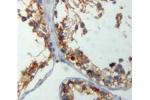 IHC-P analysis of testis tissue, with DAB staining. (CRAT 抗体  (AA 1-430))