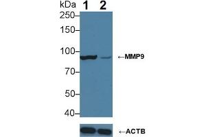 Western Blotting (WB) image for anti-Matrix Metallopeptidase 9 (Gelatinase B, 92kDa Gelatinase, 92kDa Type IV Collagenase) (MMP9) (AA 213-399) antibody (ABIN7425935)