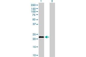 Western Blot analysis of APOM expression in transfected 293T cell line by APOM monoclonal antibody (M01), clone 1F10. (Apolipoprotein M 抗体  (AA 23-188))