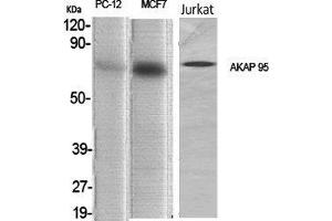 Western Blot (WB) analysis of specific cells using AKAP 95 Polyclonal Antibody. (AKAP8 抗体  (Internal Region))