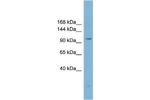 WB Suggested Anti-ACLY Antibody Titration:  0. (ACLY 抗体  (Middle Region))