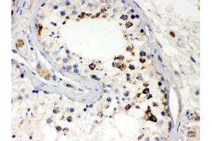 Immunohistochemistry (Paraffin-embedded Sections) (IHC (p)) image for anti-Second Mitochondria-Derived Activator of Caspase (DIABLO) (AA 56-239) antibody (ABIN3044515)