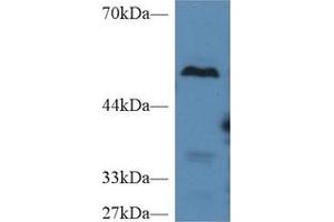Western Blot; Sample: Mouse Liver lysate; Primary Ab: 2µg/ml Rabbit Anti-Mouse TAFI Antibody Second Ab: 0. (CPB2 抗体  (AA 113-422))