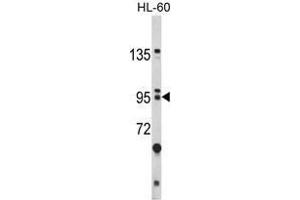 Image no. 1 for anti-Bicaudal C Homolog 1 (BICC1) (N-Term) antibody (ABIN452782) (BICC1 抗体  (N-Term))