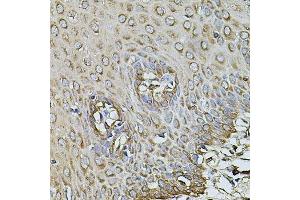 Immunohistochemistry of paraffin-embedded human esophagus using CPOX antibody. (CPOX 抗体  (AA 111-454))