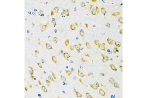 Immunohistochemistry of paraffin-embedded mouse brain using FMRP antibody (ABIN6133703, ABIN6140719, ABIN6140721 and ABIN6221705) at dilution of 1:100 (40x lens). (FMR1 抗体  (AA 500-600))