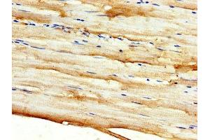 IHC image of ABIN7149882 diluted at 1:500 and staining in paraffin-embedded human skeletal muscle tissue performed on a Leica BondTM system. (DKK2 抗体  (AA 34-259))