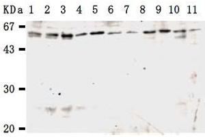 Western Blotting (WB) image for anti-Karyopherin alpha 3 (Importin alpha 4) (KPNA3) antibody (ABIN1449200) (KPNA3 抗体)