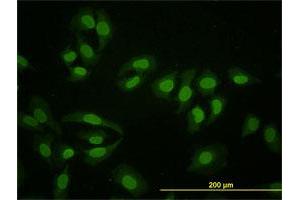 Immunofluorescence of monoclonal antibody to HNF4A on HeLa cell. (HNF4A 抗体  (AA 324-423))