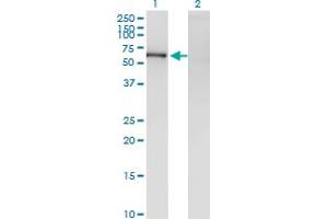Western Blot analysis of ZNF192 expression in transfected 293T cell line by ZNF192 monoclonal antibody (M01), clone 1F2. (ZNF192 抗体  (AA 1-90))