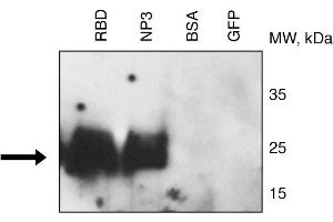 Binding of CR3022 to RBD and NP3 (fragment 3) of 2019nCoV proteins by Western blotting . (SARS-CoV-2 抗体)