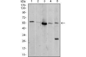 Western Blotting (WB) image for anti-V-Akt Murine Thymoma Viral Oncogene Homolog 1 (AKT1) (AA 1-150) antibody (ABIN5542263)