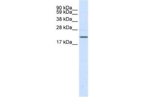 Western Blotting (WB) image for anti-Sodium Channel, Voltage-Gated, Type III, beta Subunit (SCN3B) antibody (ABIN2461577) (SCN3B 抗体)