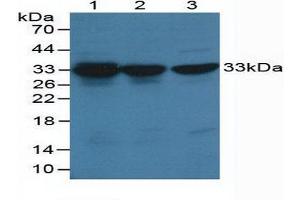 Western blot analysis of (1) Human HeLa cells, (2) Human Hepg2 Cells and (3) Human K-562 Cells. (CDK2 抗体  (AA 5-346))