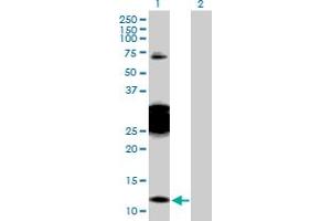 Western Blot analysis of CBY1 expression in transfected 293T cell line by CBY1 MaxPab polyclonal antibody. (CBY1/PGEA1 抗体  (AA 1-126))