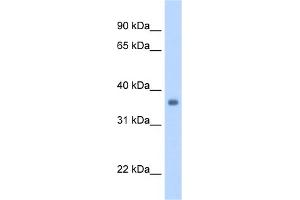 WB Suggested Anti-SGCG Antibody Titration:  1. (SGCG 抗体  (Middle Region))