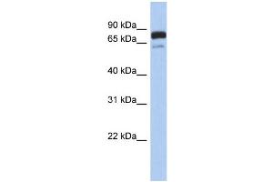 WB Suggested Anti-MTMR12 Antibody Titration: 0. (MTMR12 抗体  (Middle Region))